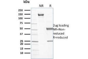 Spectrin beta Chain, Erythrocyte (SPTB) antibody