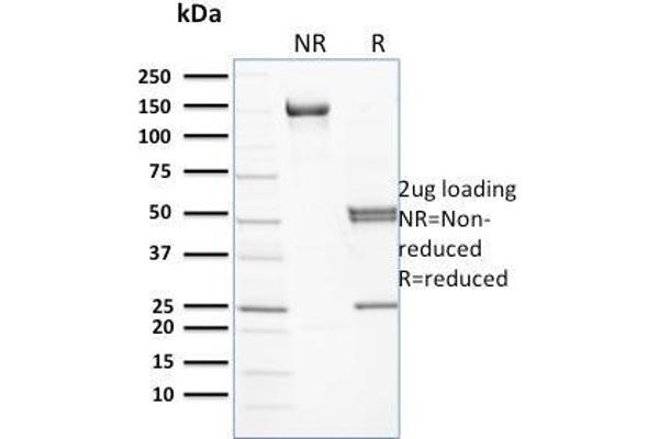 Spectrin beta Chain, Erythrocyte (SPTB) antibody