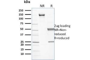 SDS-PAGE Analysis Purified Spectrin beta III Mouse Monoclonal Antibody (RG/26). (Spectrin beta Chain, Erythrocyte (SPTB) antibody)
