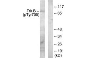 Western blot analysis of extracts from mouse kidney, using Trk B (Phospho-Tyr705) Antibody. (TRKB antibody  (pTyr706))