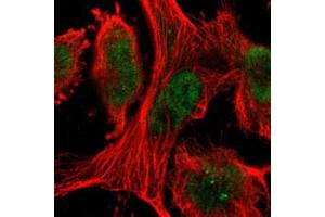 Immunofluorescent staining of U-251 MG with TAF10 polyclonal antibody  (Green) shows positivity in nucleus. (TAF10 antibody)