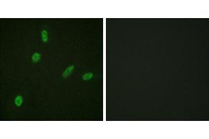 Peptide - +Immunofluorescence analysis of HeLa cells, using ETS1 (Ab-38) antibody. (ETS1 antibody  (Thr38))