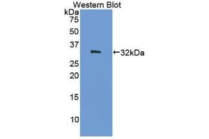 Detection of Recombinant DNMT1, Human using Polyclonal Antibody to DNA Methyltransferase 1 (DNMT1) (DNMT1 antibody  (AA 1343-1570))