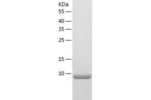 Western Blotting (WB) image for S100 Calcium Binding Protein A1 (S100A1) (AA 1-94) protein (His tag) (ABIN7285695) (S100A1 Protein (AA 1-94) (His tag))