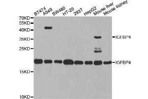 Western blot analysis of extracts of various cell lines, using IGFBP4 antibody. (IGFBP4 antibody)