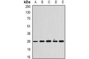 Western blot analysis of Calpain reg expression in Hela (A), SKOV3 (B), mouse heart (C), mouse spleen (D), rat lung (E) whole cell lysates. (Calpain Reg antibody)