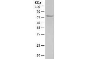 Western Blotting (WB) image for Deformed Epidermal Autoregulatory Factor 1 (Drosophila) (DEAF1) (AA 2-565) protein (His tag) (ABIN7284603) (DEAF1 Protein (AA 2-565) (His tag))