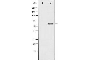 Western blot analysis of PAK1 expression in Etoposide treated 293 whole cell lysates,The lane on the left is treated with the antigen-specific peptide.