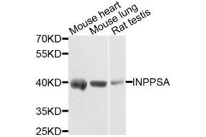Western blot analysis of extracts of various cell lines, using INPP5A antibody. (INPP5A antibody  (AA 10-200))