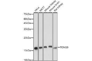 Western blot analysis of extracts of various cell lines, using TOM20 antibody (ABIN7268554) at 1:5000 dilution. (TOMM20 antibody  (AA 20-145))