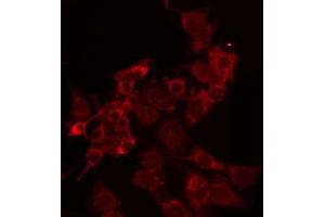 ABIN6274271 staining HuvEc by IF/ICC. (TRAIL antibody  (Internal Region))