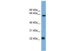 WB Suggested Anti-C21orf45 Antibody Titration:  0. (C21ORF45 antibody  (N-Term))