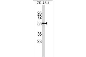 SPN Antibody (N-term) (ABIN1539314 and ABIN2846636) western blot analysis in ZR-75-1 cell line lysates (35 μg/lane). (CD43 antibody  (N-Term))