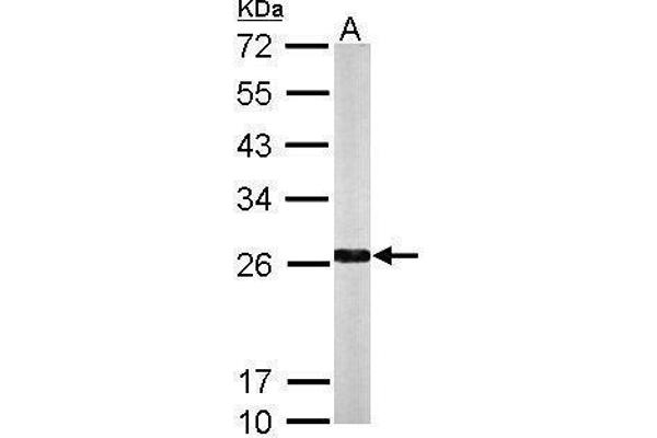 NQO2 antibody  (Center)