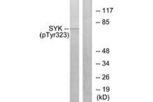 Western blot analysis of extracts from HT29 cells, using SYK (Phospho-Tyr323) Antibody. (SYK antibody  (pTyr323))