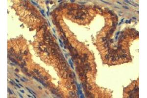 ABIN185302 (4µg/ml) staining of paraffin embedded Human Prostate. (ABCC4 antibody  (C-Term))