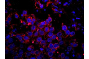 Immunofluorescence (IF) image for anti-Insulin Receptor Substrate 2 (IRS2) (AA 1288-1338) antibody (ABIN7448980) (IRS2 antibody  (AA 1288-1338))