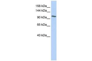 NNT antibody used at 1 ug/ml to detect target protein. (NNT antibody  (N-Term))