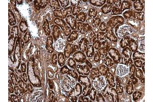 IHC-P Image HSP47 antibody [N2C2], Internal detects HSP47 protein at cytosol on mouse kidney by immunohistochemical analysis. (SERPINH1 antibody  (Internal Region))