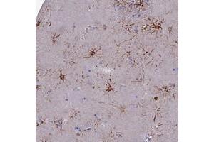 Immunohistochemical staining of human lateral ventricle with CYB561D2 polyclonal antibody  shows strong cytoplasmic positivity in fraction of glial cells. (CYB561D2 antibody)