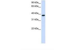 Image no. 1 for anti-Glycosyltransferase 8 Domain Containing 2 (GLT8D2) (C-Term) antibody (ABIN6738653) (GLT8D2 antibody  (C-Term))