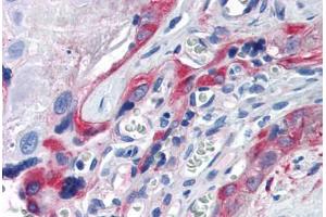 Human Placenta (formalin-fixed, paraffin-embedded) stained with TGM2 antibody ABIN337398 at 5 ug/ml followed by biotinylated goat anti-rabbit IgG secondary antibody ABIN481713, alkaline phosphatase-streptavidin and chromogen.