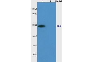 Lane 1: mouse embryo lysates Lane 2: mouse heart lysates probed with Anti Sphingomyelin Synthase 1 Polyclonal Antibody, Unconjugated (ABIN705371) at 1:200 in 4 °C. (Sphingomyelin Synthase 1 antibody  (AA 331-413))