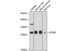 Western blot analysis of extracts of various cell lines using ETHE1 Polyclonal Antibody at dilution of 1:1000. (ETHE1 antibody)