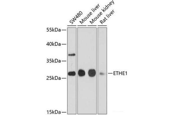 ETHE1 anticorps