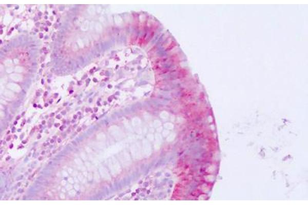 Motilin Receptor antibody  (Internal Region)