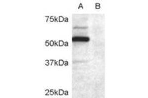 Western Blotting (WB) image for anti-Doublecortin Domain Containing 2 (DCDC2) (Internal Region) antibody (ABIN2465587) (DCDC2 antibody  (Internal Region))