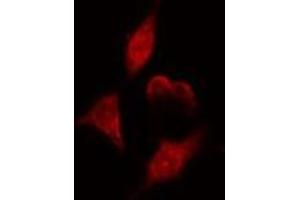 ABIN6275110 staining  HeLa cells by IF/ICC.