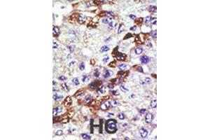 Immunohistochemistry (IHC) image for anti-Ubiquitin-Conjugating Enzyme E2E 3 (UBE2E3) antibody (ABIN3001488)