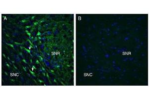 Expression of GPR55 in rat substantia nigra. (GPR55 antibody  (Extracellular))