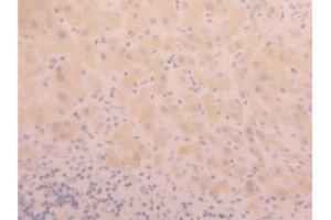 IHC-P analysis of Human Liver Tissue, with DAB staining. (PHPT1 antibody  (AA 1-125))