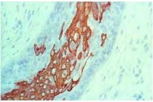 Image no. 1 for anti-Keratin 10 (KRT10) antibody (ABIN335328) (Keratin 10 antibody)