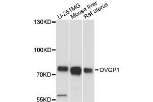 Western blot analysis of extracts of various cell lines, using OVGP1 antibody (ABIN6291552) at 1:3000 dilution.