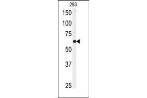 Image no. 1 for anti-Ubiquitin Specific Peptidase 3 (USP3) (N-Term) antibody (ABIN357523) (USP3 antibody  (N-Term))