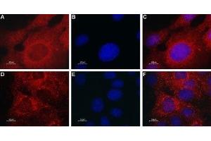 Expression of TRPML2 in mouse muscle myoblast (C2C12) cell line - Immunocytochemical staining of TRPML2 in C2C12 cells. (Mucolipin 2 (MCOLN2) (AA 212-228), (Intracellular), (N-Term) antibody)
