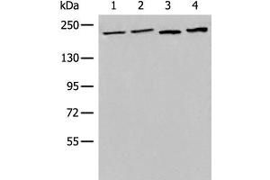 Western blot analysis of 293T cell Human metastatic malignant melanoma tissue lysates using EEA1 Polyclonal Antibody at dilution of 1:700 (EEA1 antibody)