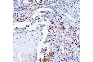 IHC analysis of FEN1 using anti-FEN1 antibody (ABIN7601617).