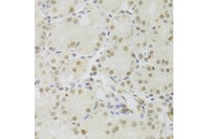 Immunohistochemistry of paraffin-embedded human stomach using PRPF3 Antibody (ABIN5973192) at dilution of 1/100 (40x lens). (PRPF3 antibody)
