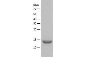 Western Blotting (WB) image for Signaling threshold Regulating Transmembrane Adaptor 1 (SIT1) (AA 62-196) protein (His tag) (ABIN7289533) (SIT1 Protein (AA 62-196) (His tag))