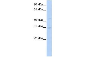 Western Blotting (WB) image for anti-Solute Carrier Family 10 (Sodium/bile Acid Cotransporter Family), Member 4 (SLC10A4) antibody (ABIN2458814) (SLC10A4 antibody)