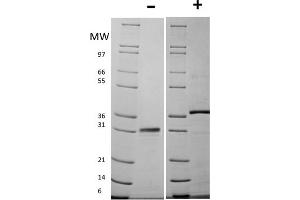 SDS-PAGE of Mouse Follistatin Recombinant Protein SDS-PAGE of Mouse Follistatin Recombinant Protein. (Follistatin Protein (FST))