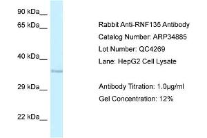 WB Suggested Anti-RNF135 Antibody   Titration: 1. (RNF135 antibody  (Middle Region))