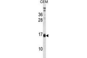 Western blot analysis in CEM cell line lysates (35ug/lane) using LALBA  Antibody . (LALBA antibody  (Middle Region))