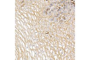 Immunohistochemistry of paraffin-embedded Human esophagus using S100 antibody (ABIN7270123) at dilution of 1:25 (40x lens).