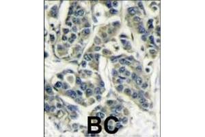 Immunohistochemistry (Paraffin-embedded Sections) (IHC (p)) image for anti-Ribosomal Protein S6 Kinase, 70kDa, Polypeptide 1 (RPS6KB1) (AA 277-306) antibody (ABIN389685)