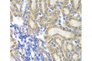 Immunohistochemistry of paraffin-embedded Rat kidney using PTGES2 Polyclonal Antibody at dilution of 1:100 (40x lens). (PTGES2 antibody)
